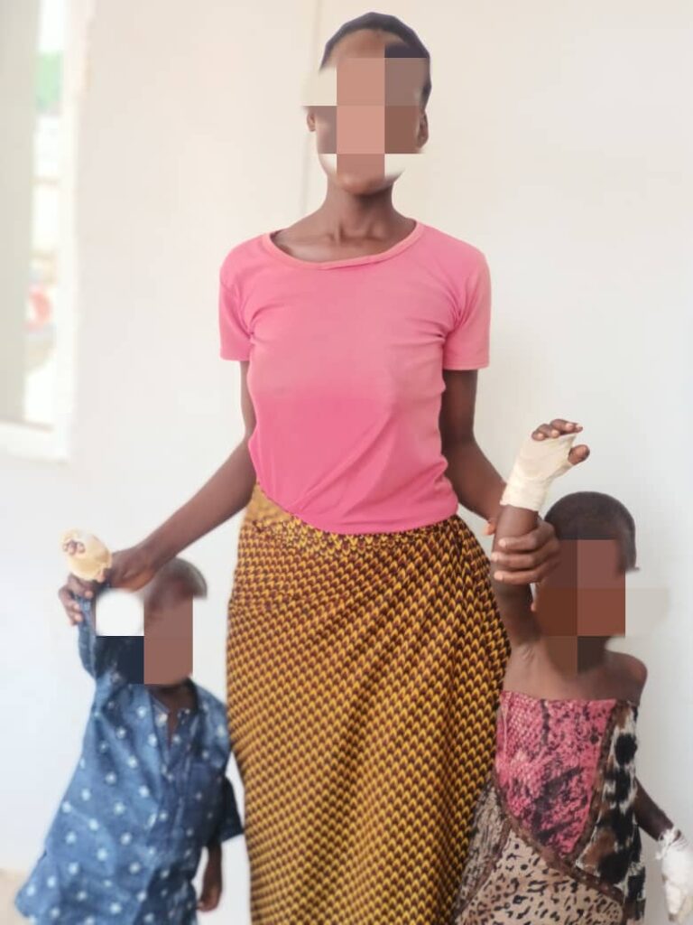 Adamawa State Police Arrest Stepmother for Severe Child Abuse